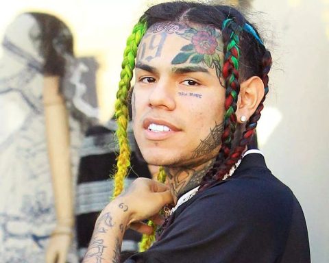 Tekashi 6ix9ine Breaks His Wrist In a Freak Accident