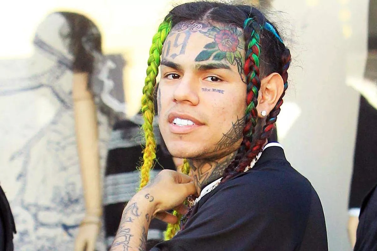 Tekashi 6ix9ine Breaks His Wrist In a Freak Accident